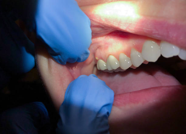 Best Broken Tooth Emergency  in Hideaway, TX